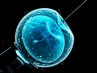 Asistovaná reprodukčná technológia (ART) krok za krokom